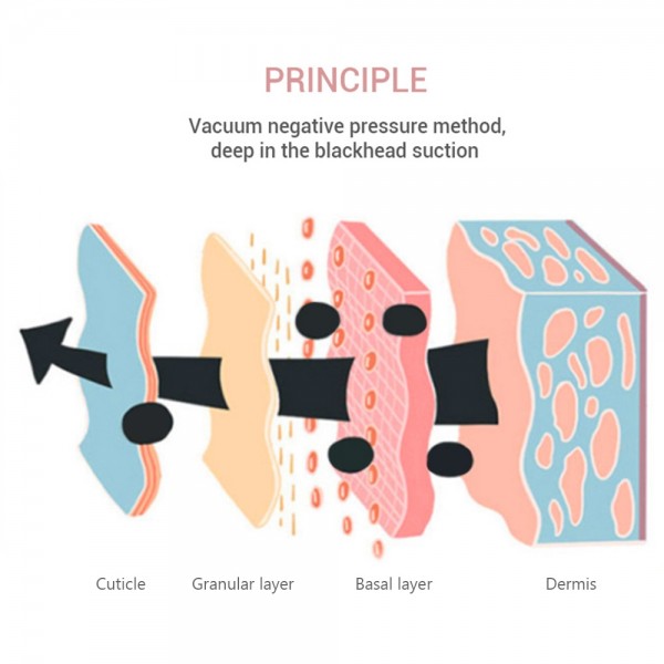 K-SKIN KD803A 3 Level Intensity Blackhead Removal Pore Cleaner Suction Rechargeable Black Spot Cleaner Facial Cleaning Machine