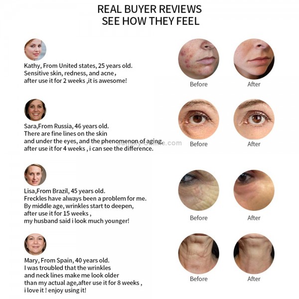 Radio Mesotherapy Electroporation Face Beauty Pen Radio Frequency LED Photon Face Skin Rejuvenation Remover Wrinkle(Pearl White)