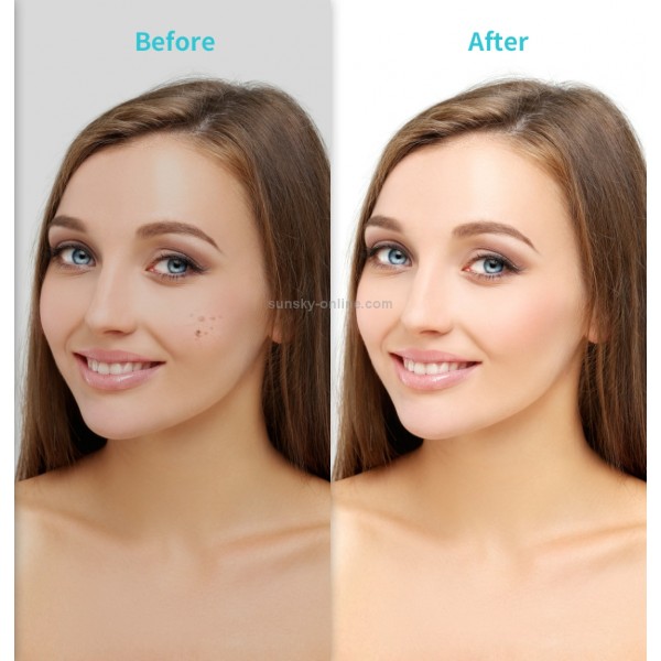 Xpreen XPRE061 Professional Dark Spot Remover Freckle Tattoo Chargeable Wart Mole Remover, with LED Screen and Spotlight(Tarnish)