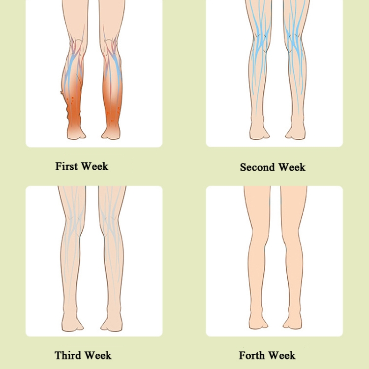 Leg-Massager-Calf-Air-Wave-Massager-Household-Varicose-Vein-Physiotherapy-Device-Specification-Upgrade-Fever-Type-TBD0571989102