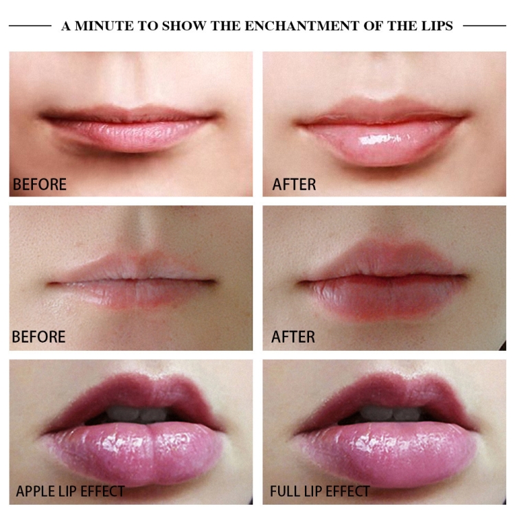 Silicone-Lip-Plumper-Device-Electric-Lip-Plump-Enhancer-Care-Tool-TBD06021834