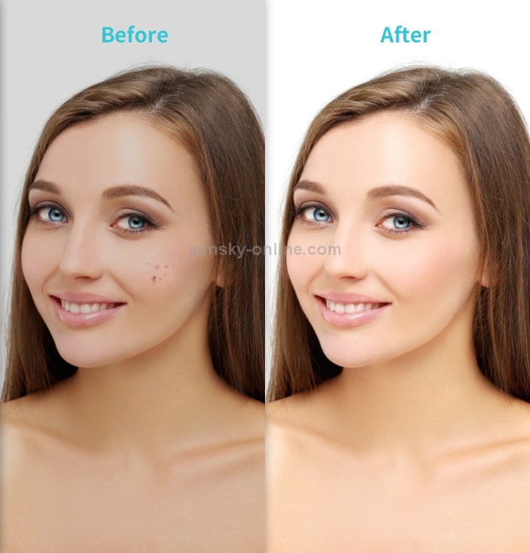 Xpreen-XPRE061-Professional-Dark-Spot-Remover-Freckle-Tattoo-Chargeable-Wart-Mole-Remover-with-LED-Screen-and-SpotlightTarnish-HC7966Q